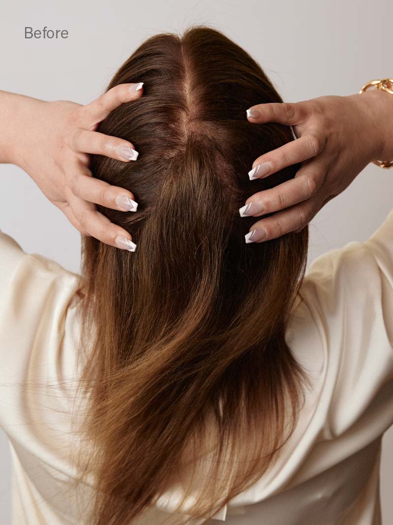 Scalp-Fill-ins_On-Fig_Ecomm_Alison_ChocolateBrown_Back_Before_2c9780f1-f2e7-428a-97a7-c8355d4dd03f_800x.jpg?v\u003d1714696735\u0026em-format\u003dauto